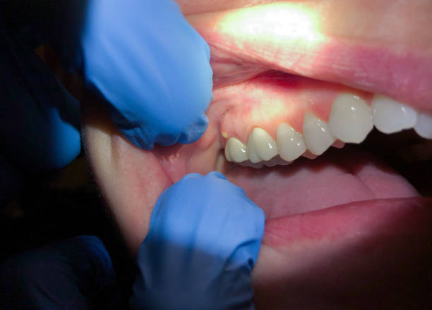 Best After-Hours Emergency Dentist in Campbelltown, PA
