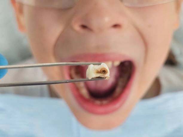 Best After-Hours Emergency Dentist in Campbelltown, PA